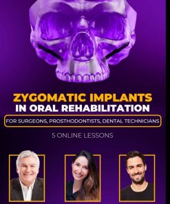 OHI-S Zygomatic Implants in Oral Rehabilitation