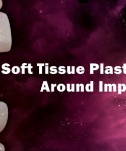 OHI-S Soft Tissue Plastic Surgery Around Implants