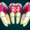 Top 10 Best Courses at Osteocom for Dentists