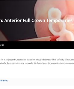 Anterior Full Crown Temporaries