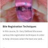 Bite Registration Techniques