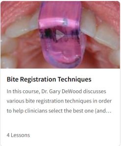 Bite Registration Techniques