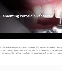 Cementing Porcelain Veneers