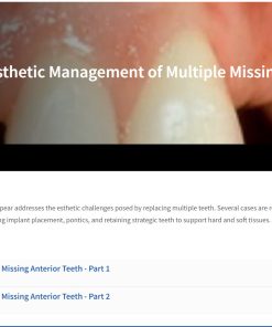 Esthetic Management of Multiple Missing Anterior Teeth