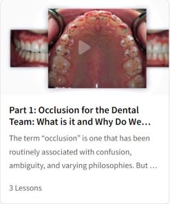 Occlusion for the Dental Team