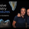 Osteocom Adhesive Dentistry Procedures
