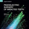 Piezoelectric surgery of impacted teeth