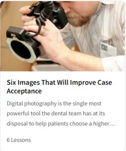 Six Images That Will Improve Case Acceptance