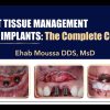 Soft Tissue Management for Implants