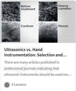 Ultrasonics vs. Hand Instrumentation
