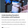 Understanding Panadent Articulators and Facebows