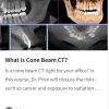 What Is Cone Beam CT