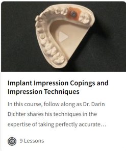 Implant Impression Copings and Impression Techniques