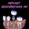 Implant Ninja Implant Restorations 101