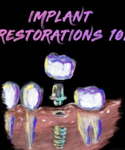 Implant Ninja Implant Restorations 101