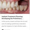Implant Treatment Planning