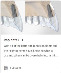 Implants 101