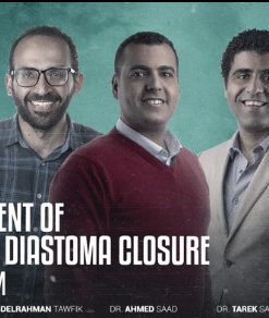 Management of Class 4 & Diastema Closure Program