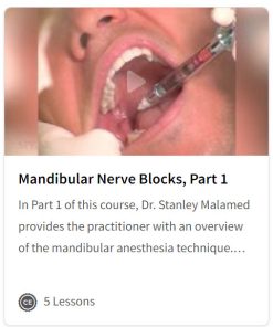 Mandibular Nerve Blocks