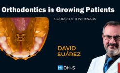 Orthodontics in Growing Patients 