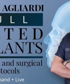 Osteocom Full Tilted Implants Prosthetic and Surgical Protocols