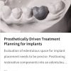 Prosthetically Driven Treatment Planning for Implants
