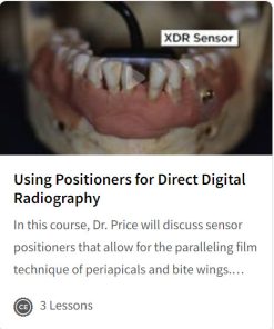 Using Positioners for Direct Digital Radiography