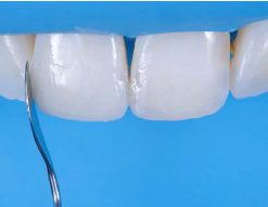 Aesthetic Dentistry Congress in Milan