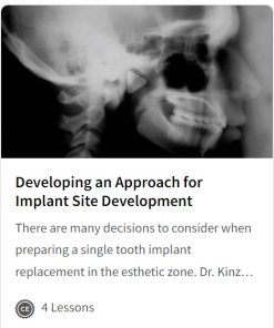 Developing an Approach for Implant Site Development