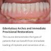 Edentulous Arches and Immediate Provisional Restorations
