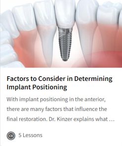 Factors to Consider in Determining Implant Positioning