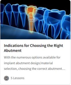 Indications for Choosing the Right Abutment