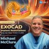EXOCAD Implant Restorations