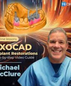 EXOCAD Implant Restorations