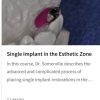 Single Implant in the Esthetic Zone
