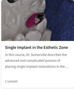Single Implant in the Esthetic Zone
