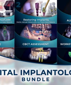 The Ultimate Digital Implantology Course Bundle