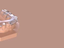 The occlusal Plane System - predictable approach when dealing with complex and functional cases in everyday practice 