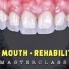 FMR Online – Full Mouth Reconstruction – Online
