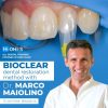 Ohi-s Bioclear Dental Restoration Method