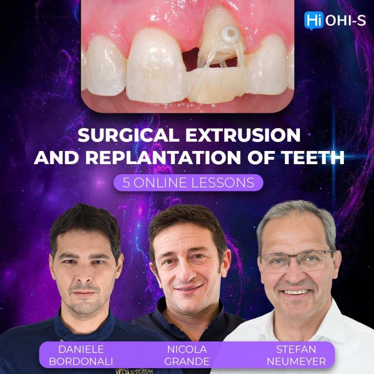 OHI-S Surgical Extrusion and Replantation of Teeth - dental-book.net