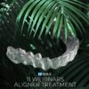 Aligners from A to Z