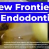 Frontiers in Endodontics: Guide to Predictable Practice