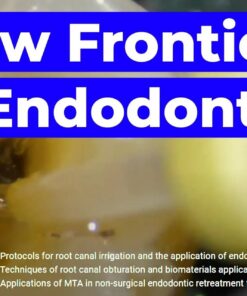 Frontiers in Endodontics: Guide to Predictable Practice