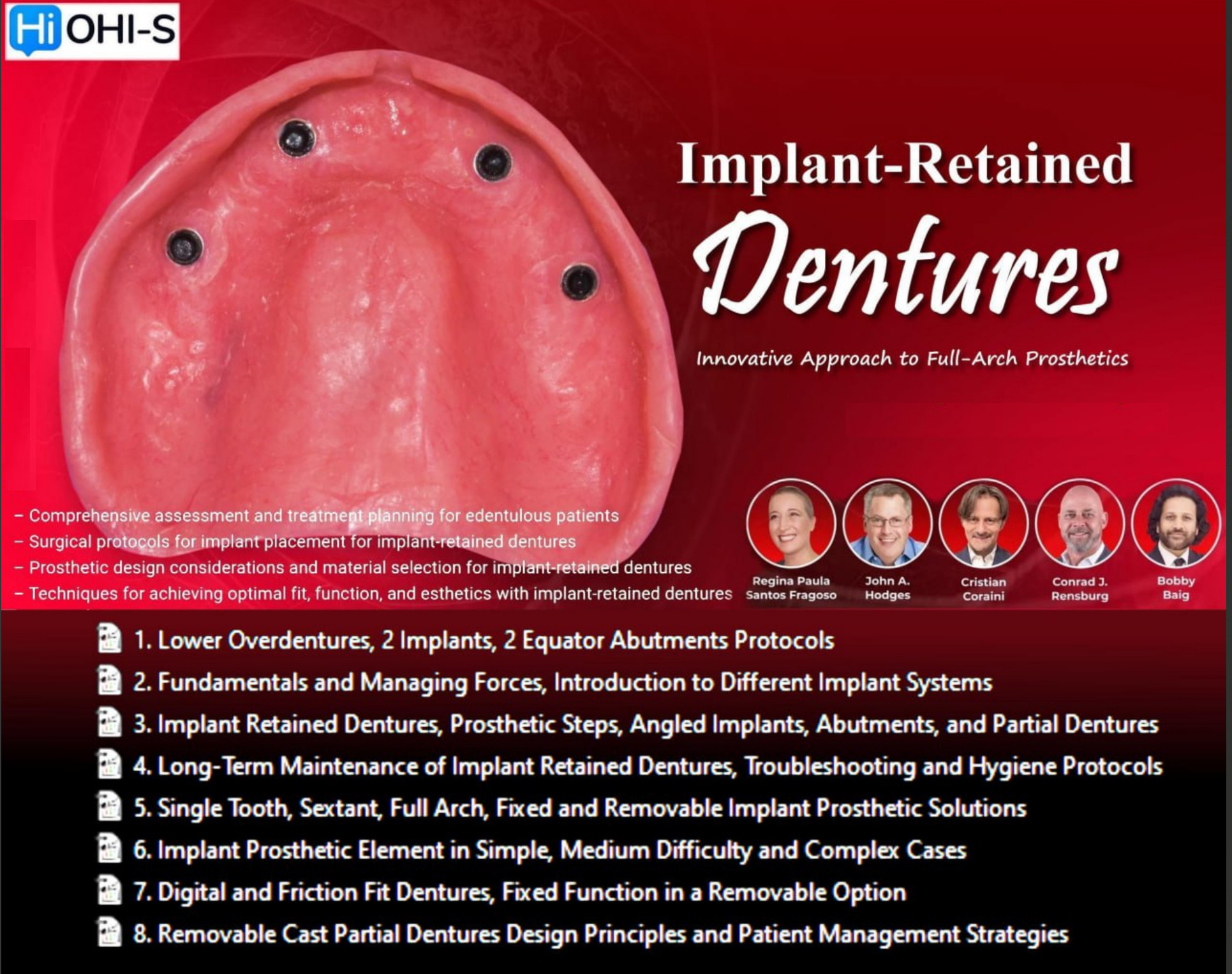 Implant-Retained Dentures