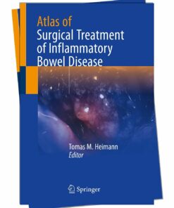 Comprehensive Guide to Surgical Treatment of Inflammatory Bowel Disease 2024