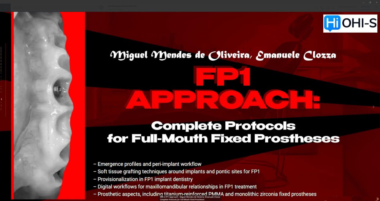 OHI-S FP1 Approach - Miguel Mendes de Oliveira, Emanuele Clozza Complete Protocols for Full-Mouth Fixed Prostheses