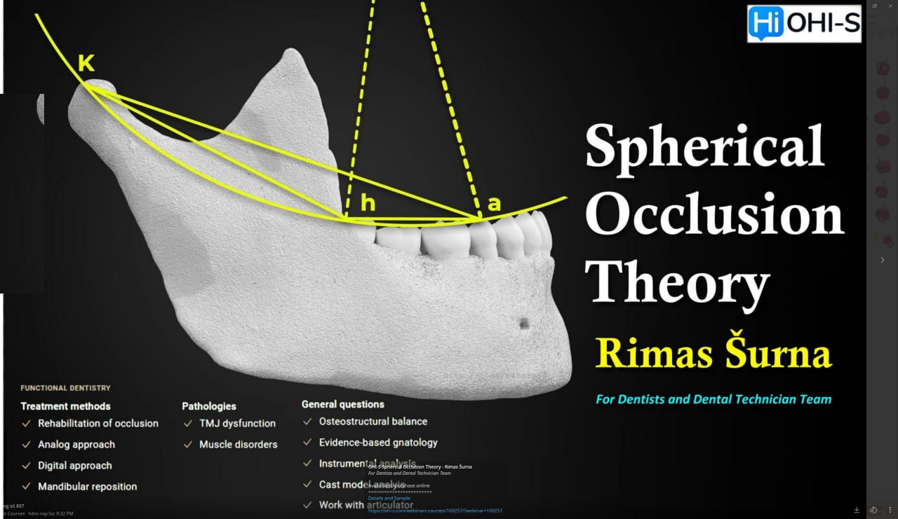 OHI-S Spherical Occlusion Theory - Rimas Šurna For Dentists and Dental Technician Team