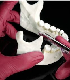 Exodontia Comprehensive Oral Surgery