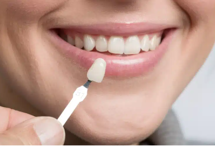 Cosmetic Dentistry